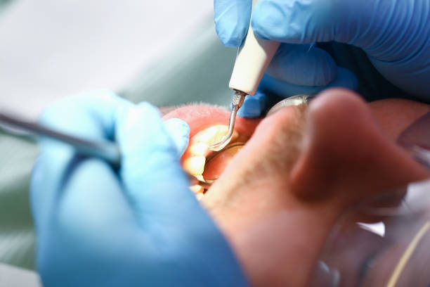 Best Emergency Treatment for Oral Infections in North Valley Stream, NY
